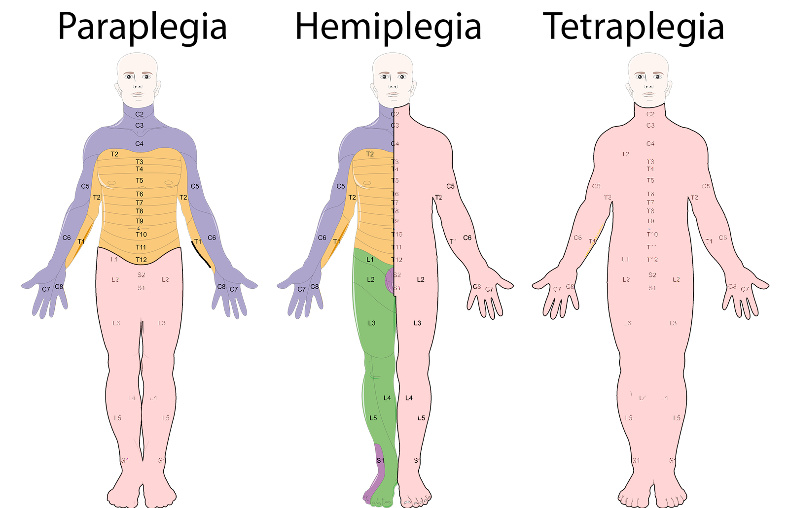 Neurological Disorders- 1- manahomeo.com