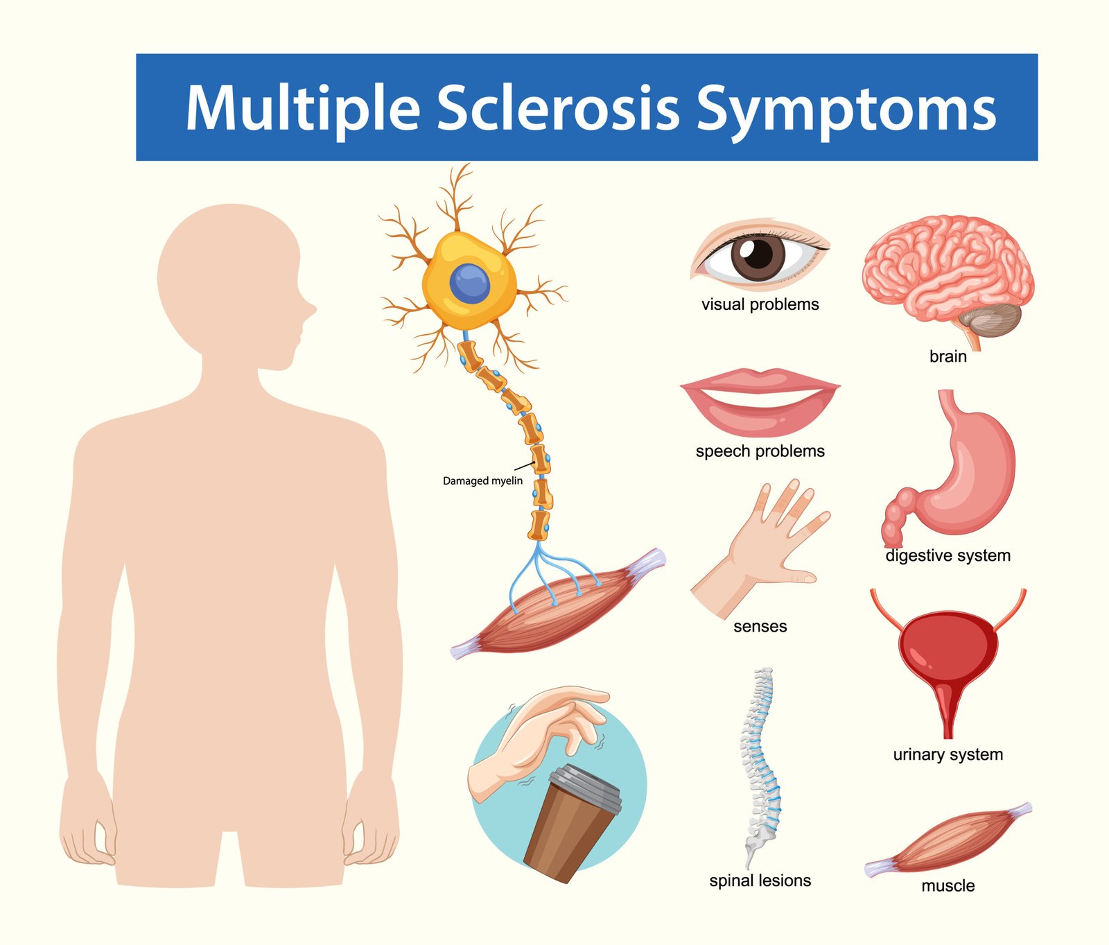 Neurological Disorders- 2 scaled- manahomeo.com