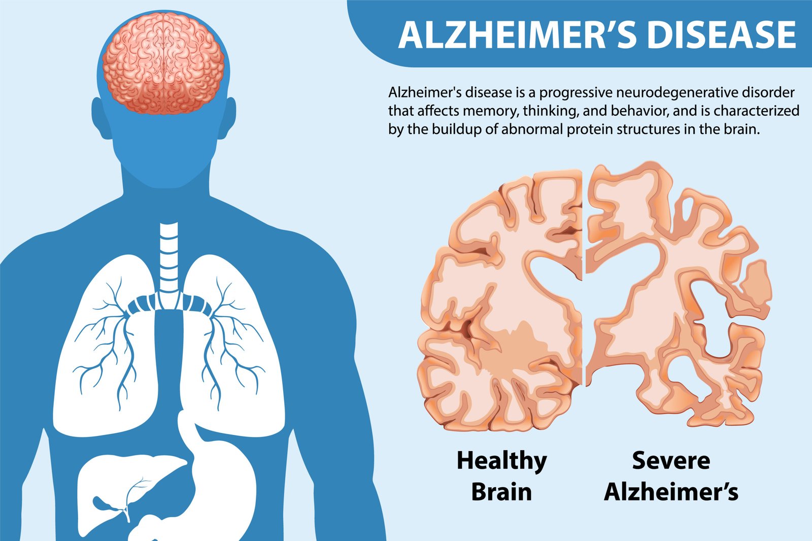 Neurological Disorders- 3 scaled- manahomeo.com