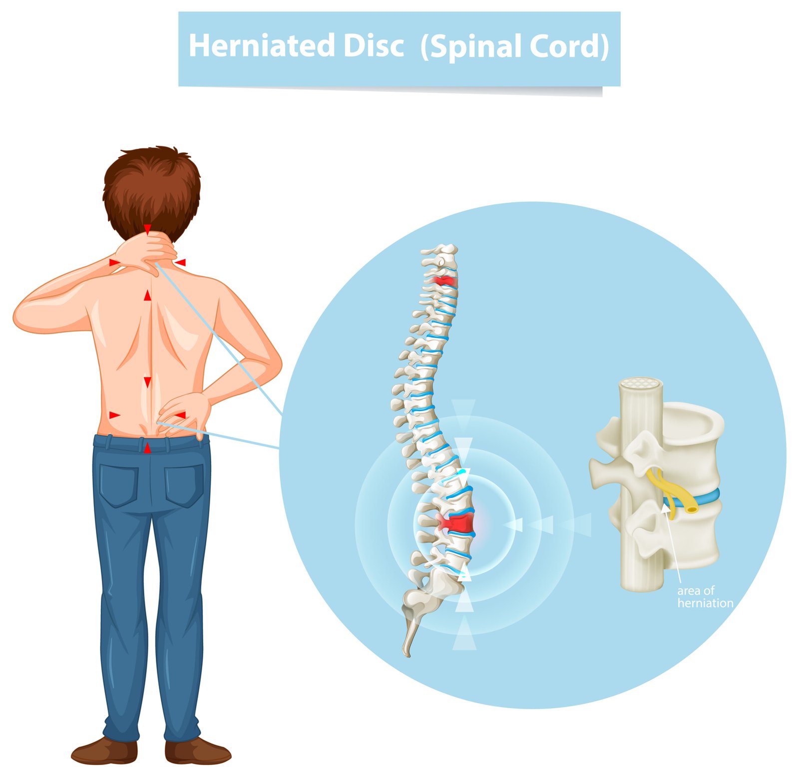 Joint, Bone & Musculoskeletal Disorders- 35316 scaled- manahomeo.com