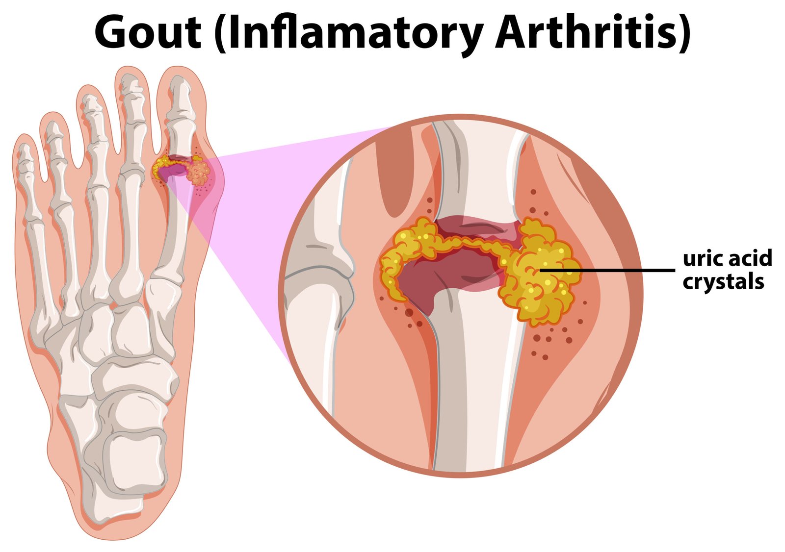 Joint, Bone & Musculoskeletal Disorders- 9277 scaled- manahomeo.com