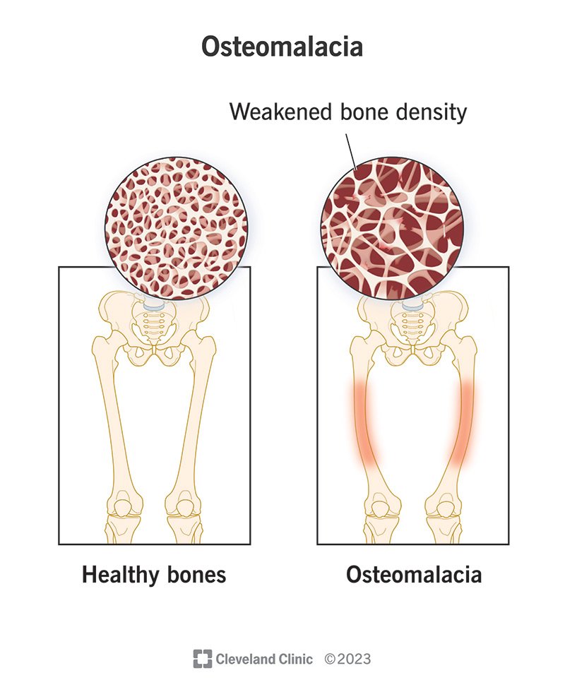 Joint, Bone & Musculoskeletal Disorders- e- manahomeo.com