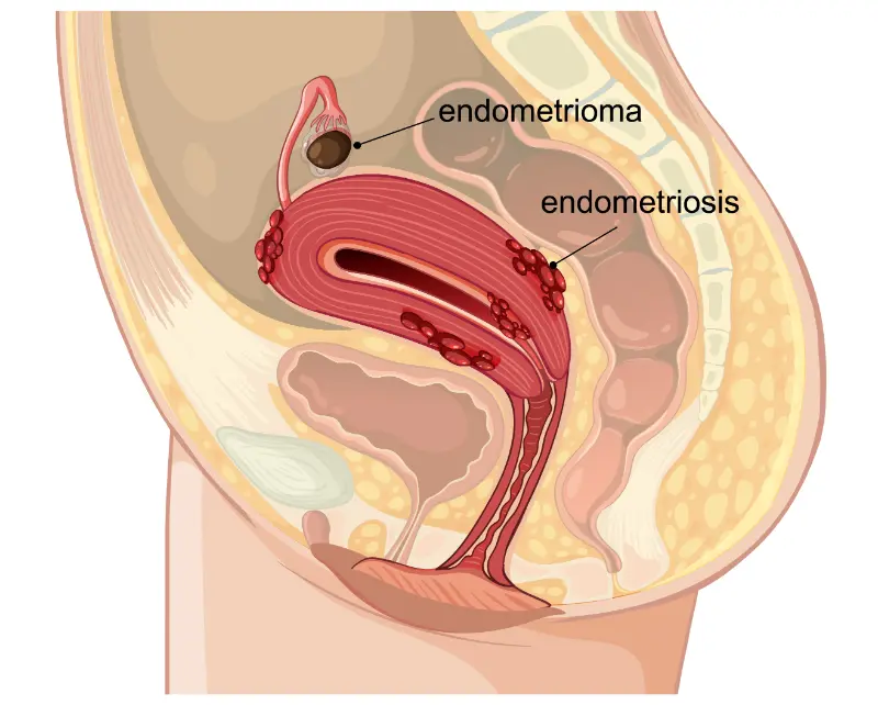 Gastrointestinal Disorders- ft- manahomeo.com
