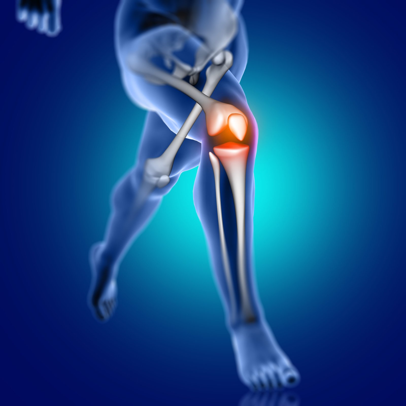 Joint, Bone & Musculoskeletal Disorders- q scaled- manahomeo.com