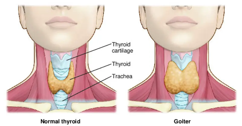 Hormonal Disorders- repview- manahomeo.com