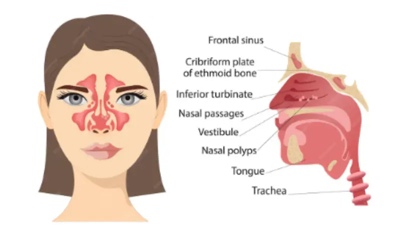 Respiratory Disorders- uytr- manahomeo.com